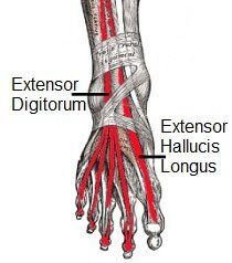 Tendonitis, inflammation of the foot tendons, can cause pain