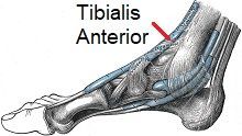 Inflammation in the Tibialis Anterior tendon causes pain on top of the foot